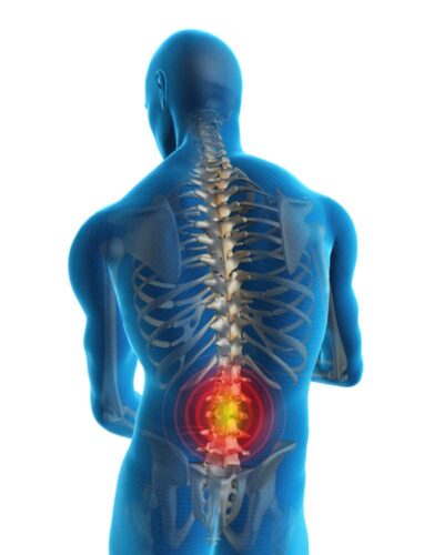 low back pain treatment bedford bedfordshire